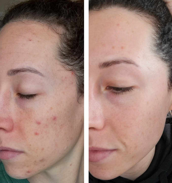 Before and after using No Bad Days Skincare Salt Spray - Salt spray results